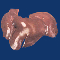 Liver